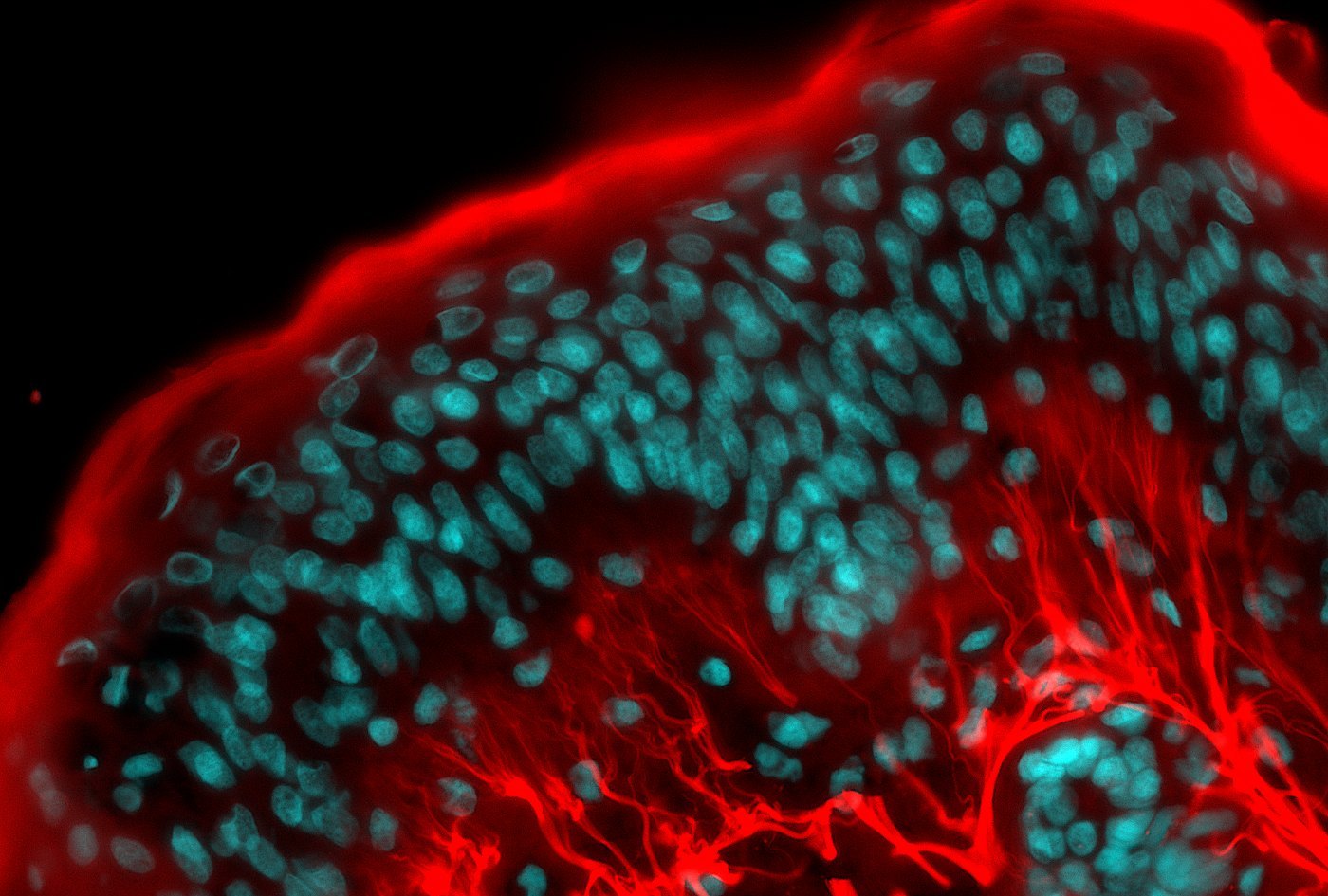 Fluorescence imaging of UV-stressed ex vivo human skin, untreated control