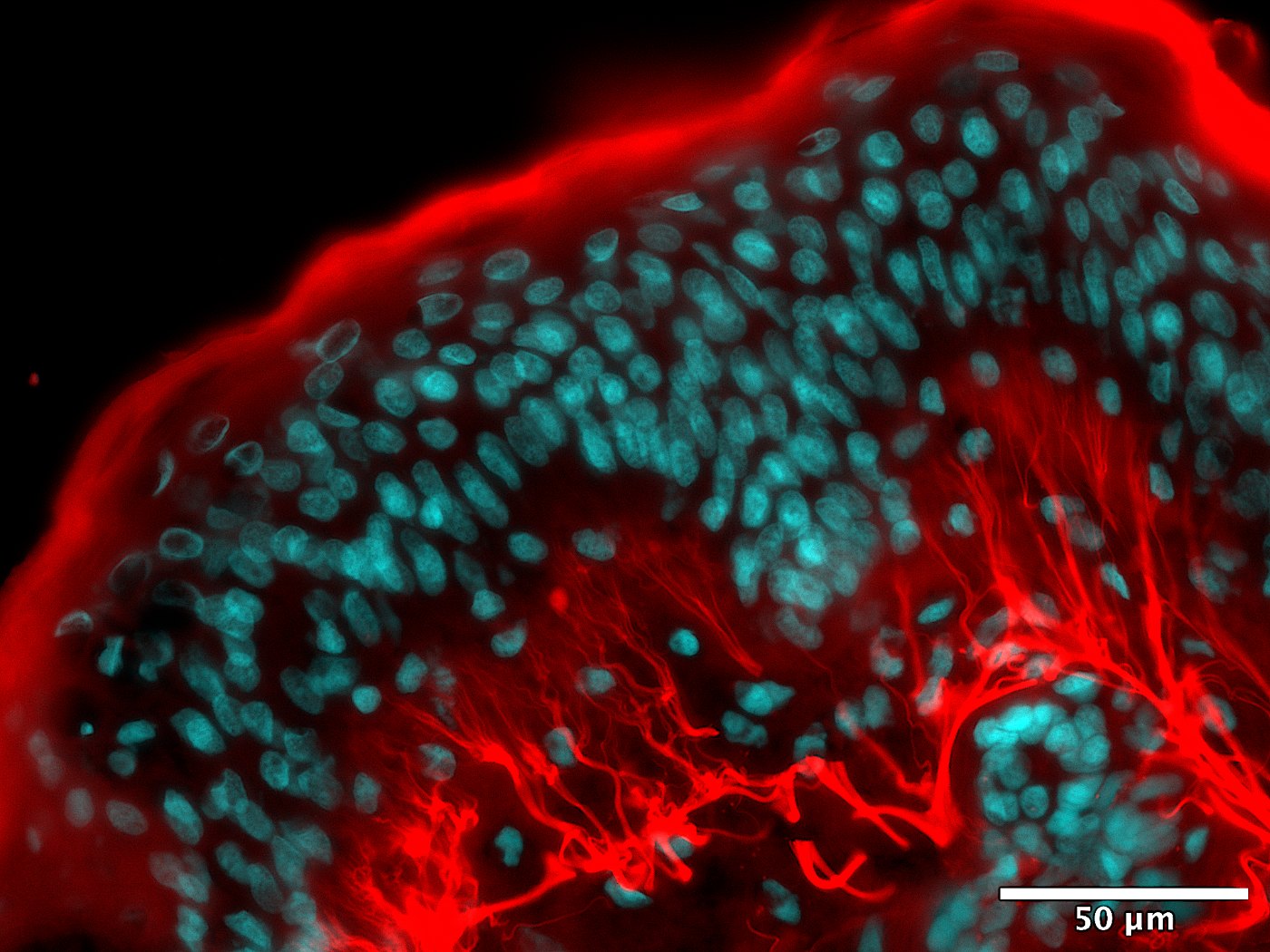 Fluorescence imaging of untreated control skin showing extensive red carbonylation