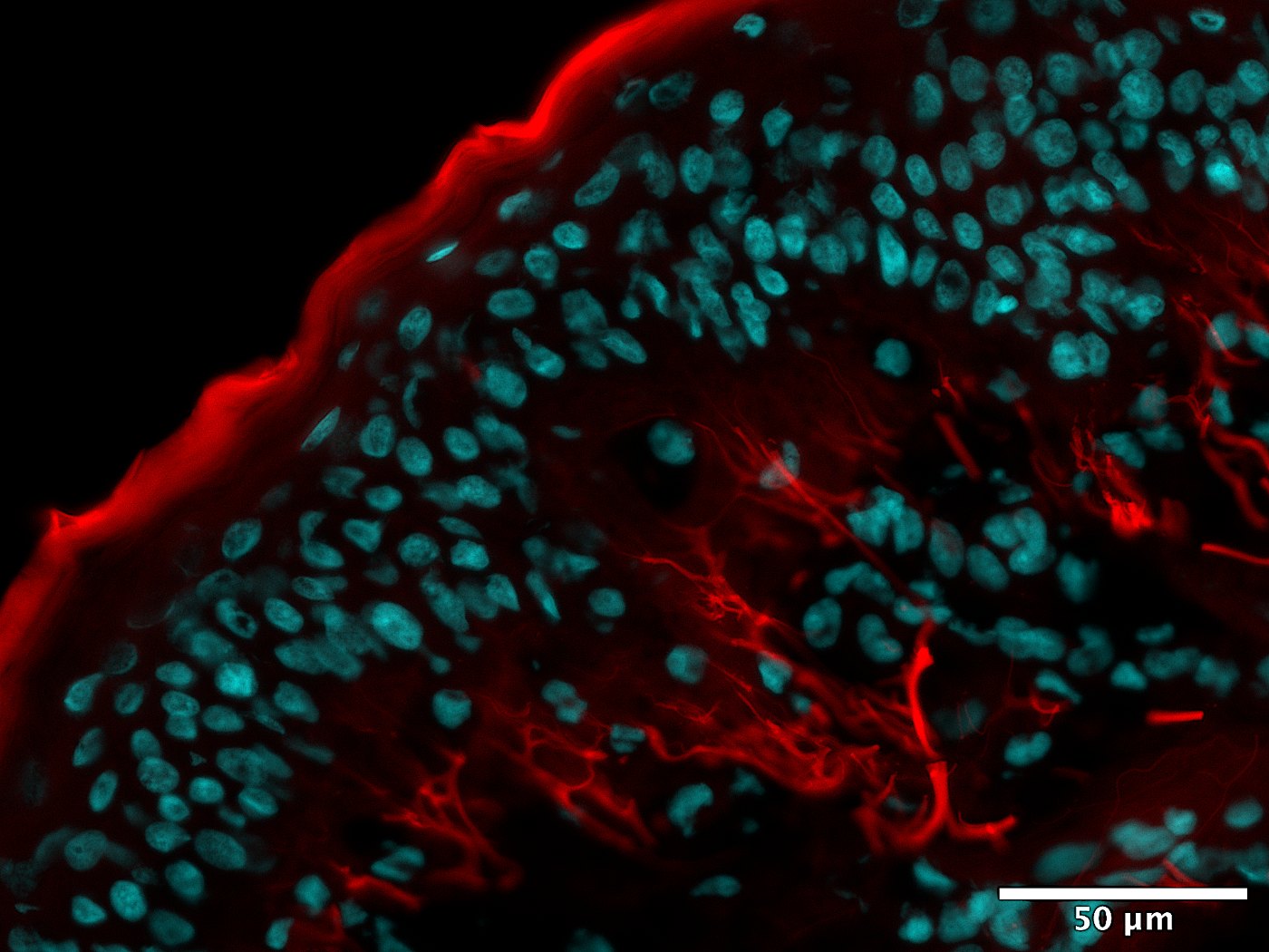 Fluorescence imaging of product-treated skin showing reduced red carbonylation